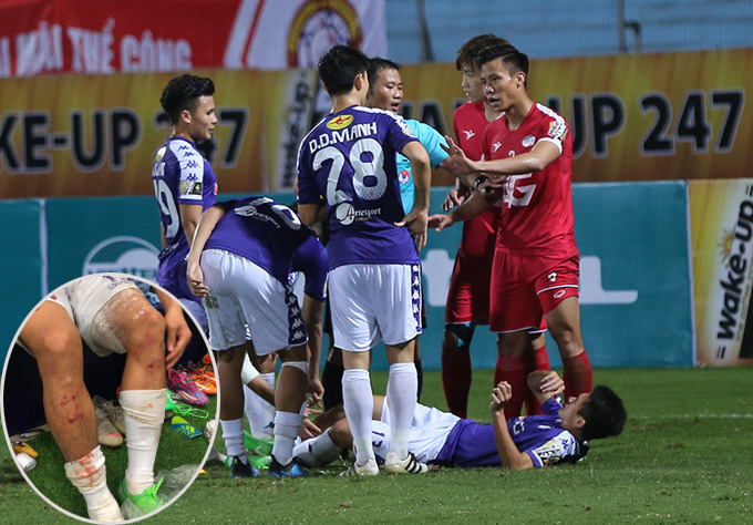 HLV Hà Nội FC bức xúc vì Quế Ngọc Hải thoát thẻ đỏ ở trận derby
